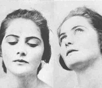 eyelids